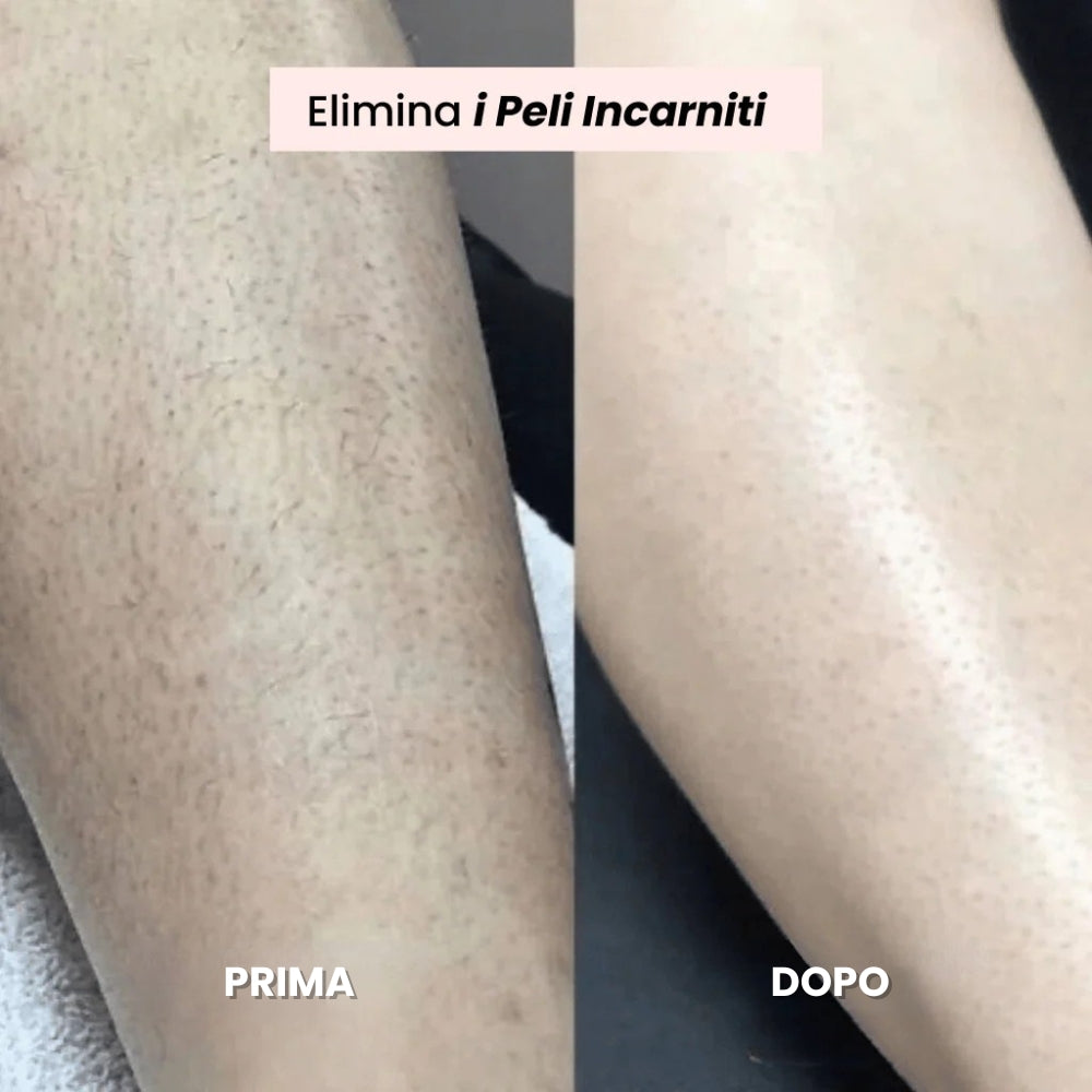 Desy® - Rasoio da Donna